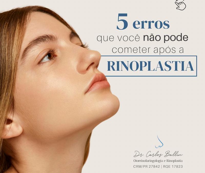 rinoplastia curitiba Carlos Ballin