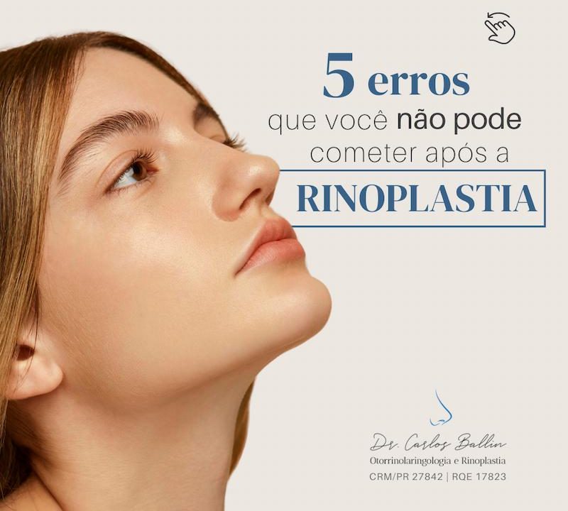 rinoplastia curitiba Carlos Ballin