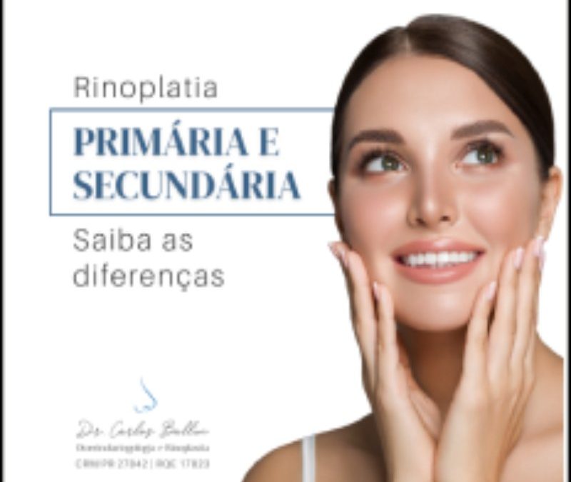 rinoplastia curitiba Carlos Ballin