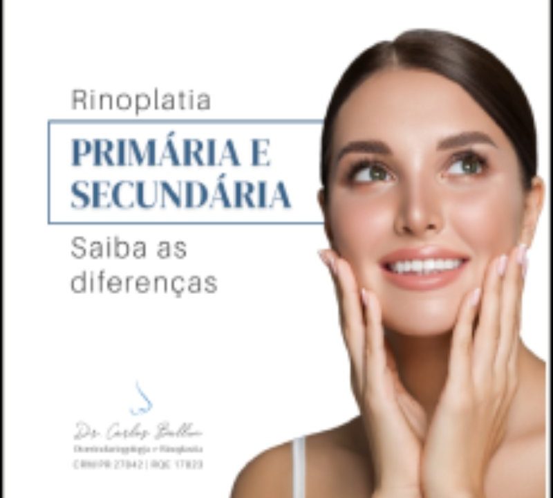 rinoplastia curitiba Carlos Ballin