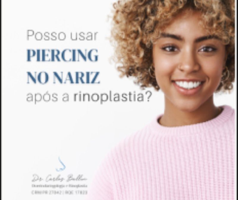 rinoplastia curitiba Carlos Ballin