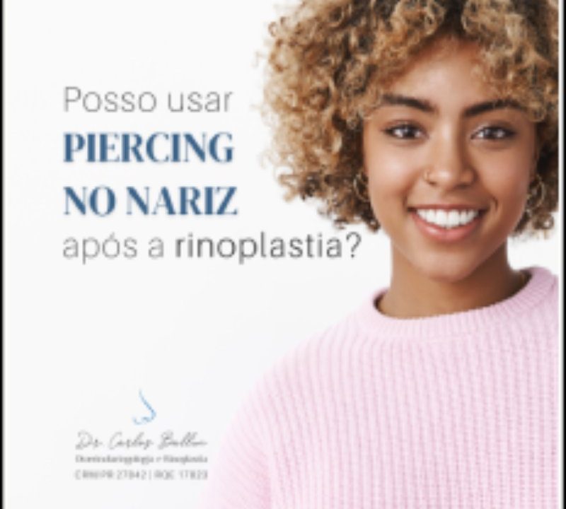 rinoplastia curitiba Carlos Ballin