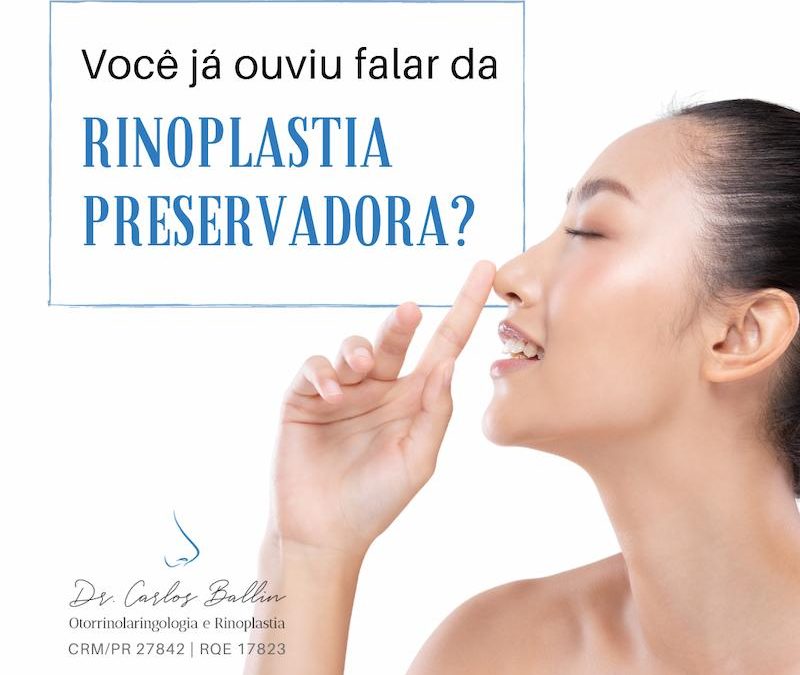 rinoplastia curitiba Carlos Ballin