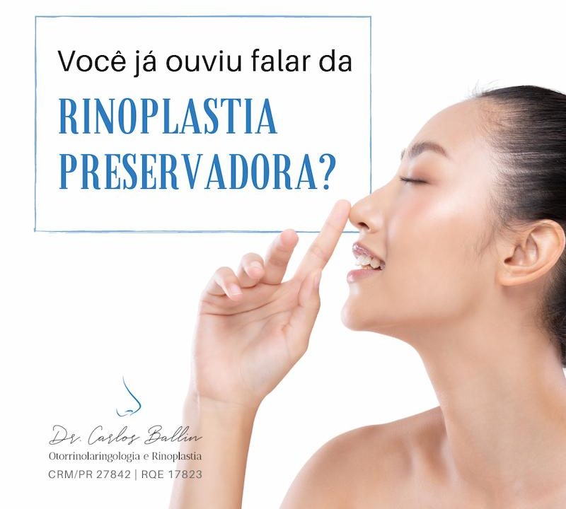 rinoplastia curitiba Carlos Ballin