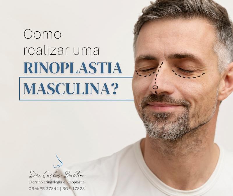 rinoplastia curitiba Carlos Ballin