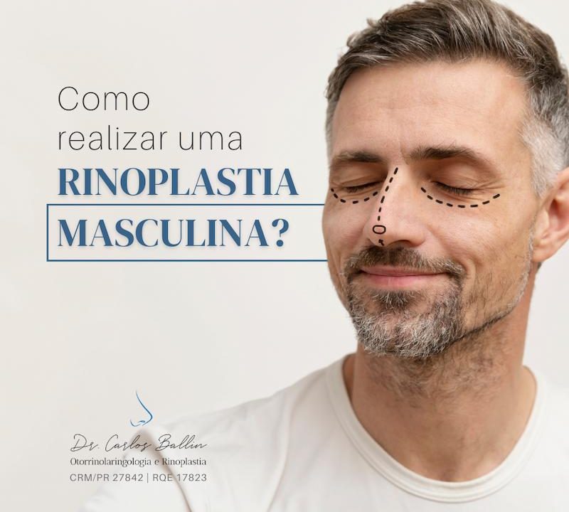 rinoplastia curitiba Carlos Ballin