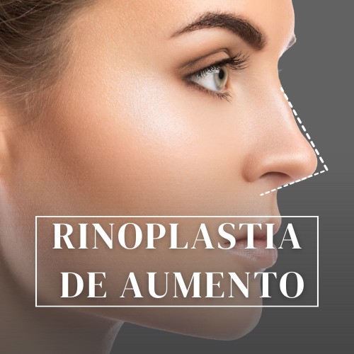 rinoplastia curitiba Carlos Ballin