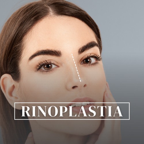 rinoplastia curitiba Carlos Ballin